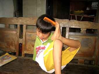 Đôi chân kỳ diệu của cậu học sinh tật nguyền - 2