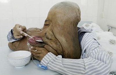 Những bệnh lạ ở châu Á trong thập kỷ qua - 4