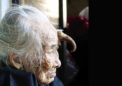 Những bệnh lạ ở châu Á trong thập kỷ qua - 1