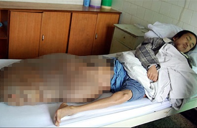 Những bệnh lạ ở châu Á trong thập kỷ qua - 3