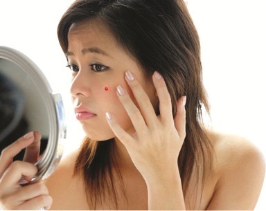 Ngăn ngừa mụn trứng cá lúc giao mùa - 1 Ngăn ngừa mụn trứng cá lúc giao mùa - 1