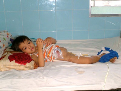 Chung tay tìm lại phép màu cho “chú lính chì” Văn Danh - 1