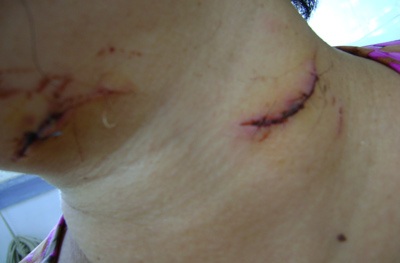 “Cướp” con, chém trọng thương mẹ chồng cũ - 1 “Cướp” con, chém trọng thương mẹ chồng cũ - 1