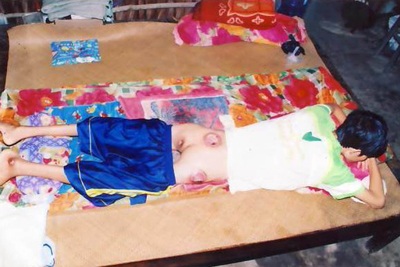 Ước mơ của chàng trai nằm liệt giường - 2