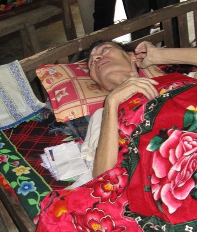 Người đàn ông hơn 40 năm sống cùng đầu đạn kêu cứu - 1