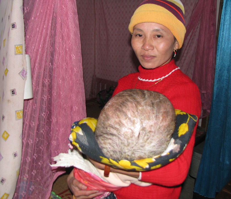 Mẹ chỉ biết nhìn con trong đau đớn, tuyệt vọng - 2