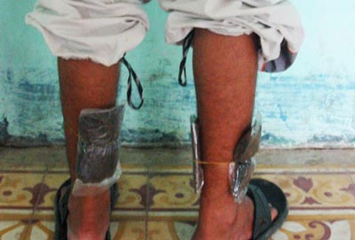 Dùng độc chiêu đưa ma túy vào trường cai - 2 Dùng độc chiêu đưa ma túy vào trường cai - 2