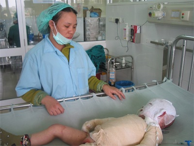 Ngằn ngặt tiếng khóc của bé 3 tuổi bị bỏng toàn thân - 3 Ngằn ngặt tiếng khóc của bé 3 tuổi bị bỏng toàn thân - 3