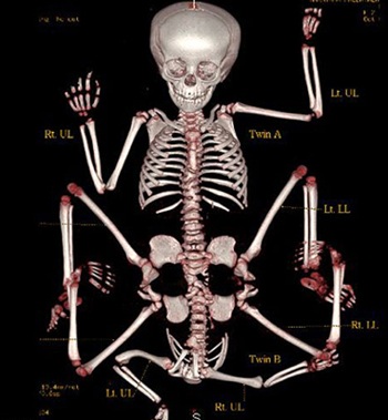 Gặp lại cô bé 8 chi thuở nào - 5