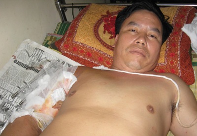 Thiếu tá biên phòng bị găm hàng chục viên đạn vào cánh tay - 1 Thiếu tá biên phòng bị găm hàng chục viên đạn vào cánh tay - 1