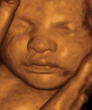 Có nên chụp ảnh thai nhi? - 1