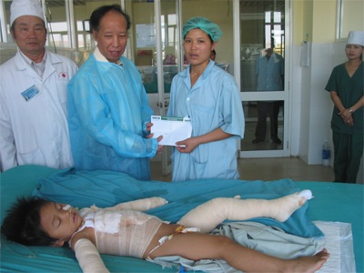 Bé 3 tuổi bỏng nước sôi toàn thân xuất viện - 5