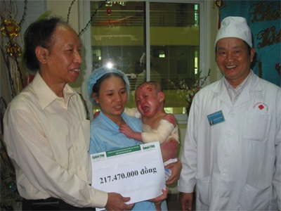 Bé 3 tuổi bỏng nước sôi toàn thân xuất viện - 3