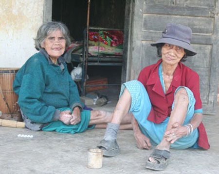 50 năm sống với bệnh nhân phong - 2 50 năm sống với bệnh nhân phong - 2