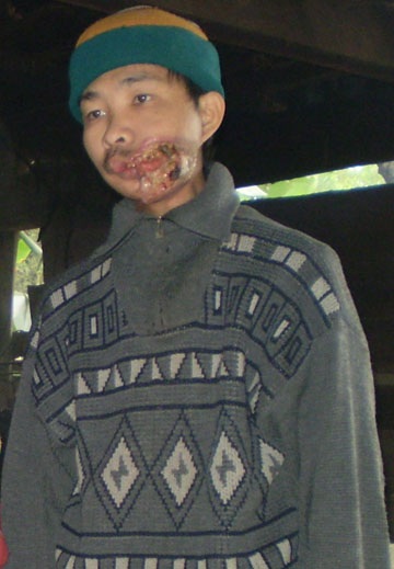 5 con thất thểu vì cha mang bệnh hiểm nghèo - 1