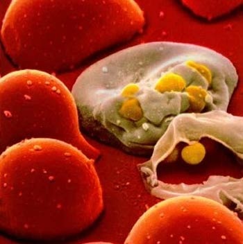 Virus HIV có thể trốn trong tủy xương - 1 Virus HIV có thể trốn trong tủy xương - 1