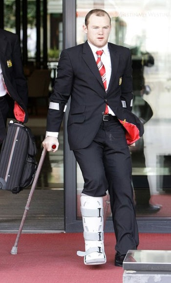 Rooney có thể phải nghỉ từ 2 đến 4 tuần - 1