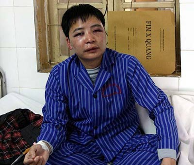 Yêu cầu điều tra lại vụ phóng viên bị hành hung - 1