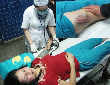 Nữ giáo viên bị chồng cũ hành hung dã man - 1 Nữ giáo viên bị chồng cũ hành hung dã man - 1
