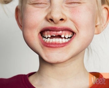 Cười hết cỡ, tăng 7 năm tuổi thọ - 1 Cười hết cỡ, tăng 7 năm tuổi thọ - 1