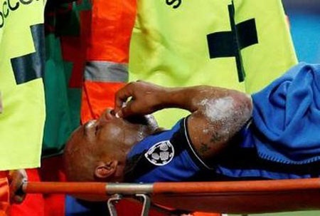 Maicon bị gãy răng cửa vì đòn bả vai của Messi - 1 Maicon bị gãy răng cửa vì đòn bả vai của Messi - 1