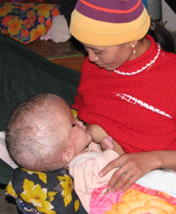 Vĩnh biệt bé Nguyễn Văn Duy - 1