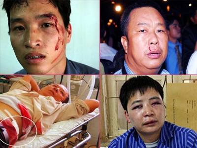Nhức nhối tình trạng hành hung, cản trở nhà báo tác nghiệp - 1 Nhức nhối tình trạng hành hung, cản trở nhà báo tác nghiệp - 1