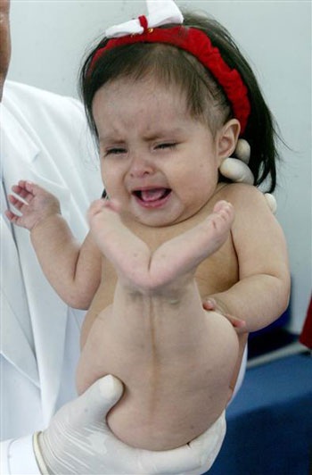 Gặp lại cô bé "nàng tiên cá" ở Peru - 3