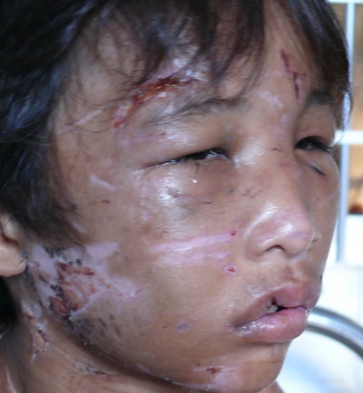 Cháu bé 14 tuổi bị hành hạ như thời trung cổ - 2 Cháu bé 14 tuổi bị hành hạ như thời trung cổ - 2