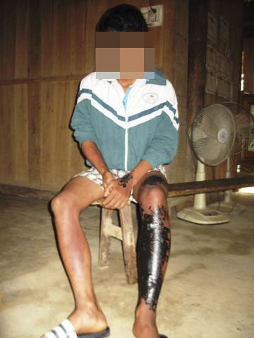 3 thanh niên chơi đêm “no đòn” vì ham “của lạ” - 2