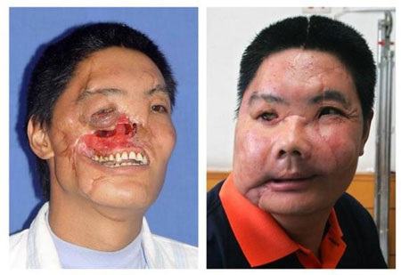 Điểm những ca ghép mặt trên thế giới - 5