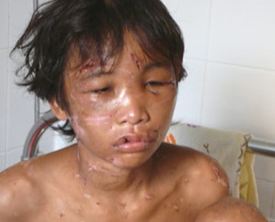“Phải xử lý đủ độ răn đe để giải tỏa căm phẫn” - 1 “Phải xử lý đủ độ răn đe để giải tỏa căm phẫn” - 1