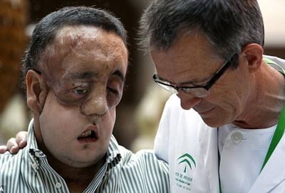 Người ghép toàn bộ khuôn mặt lộ diện - 2 Người ghép toàn bộ khuôn mặt lộ diện - 2