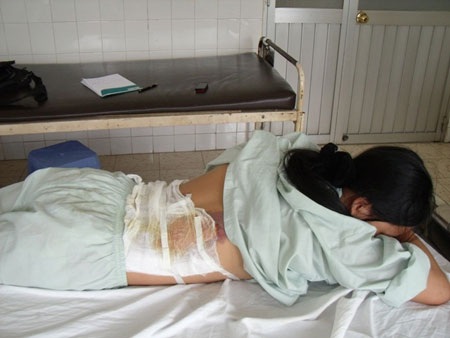 Osin “tố” bị chủ nhà tạt nước sôi gây bỏng  - 1