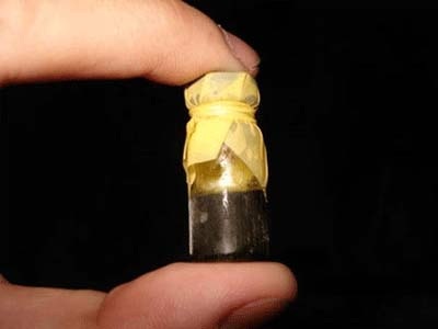 Tử vong vì uống mật gấu - 1