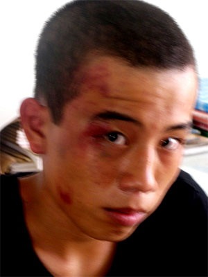 Tranh giành bạn gái, học sinh gây án mạng nhầm - 1