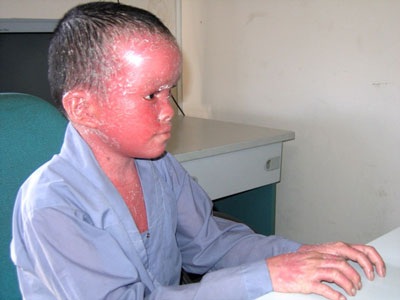 Bức tâm thư của cậu bé bị bạn bè xa lánh - 1