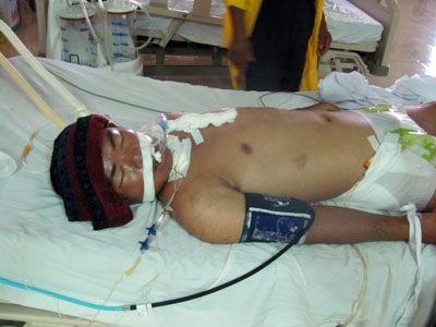 Nghi ăn trộm, đánh người dã man - 1 Nghi ăn trộm, đánh người dã man - 1