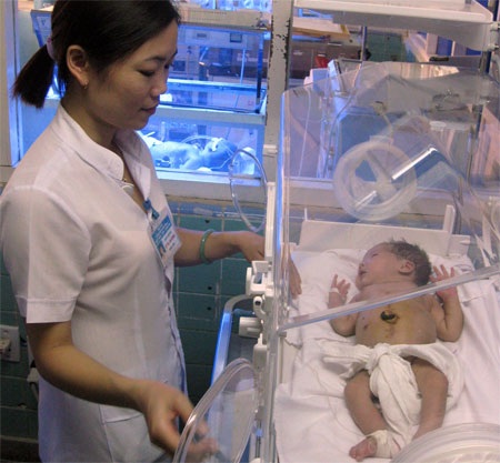 Cứu sống một trẻ sơ sinh có bệnh lý hiếm gặp - 1