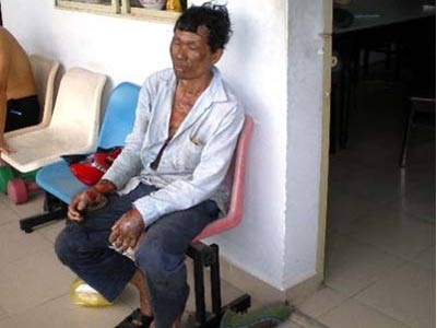 Mưu sát vợ bằng 40 lít xăng  - 1