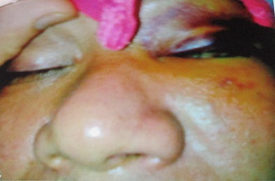 Cần xử lý dứt điểm vụ hành hung dã man tại khu vực Đền Lừ - 1