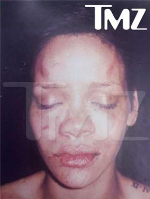 Chris Brown không thể tới Anh vì tội đánh người yêu - 1 Chris Brown không thể tới Anh vì tội đánh người yêu - 1