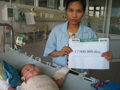 Bé 11 tháng tuổi bỏng nước sôi sắp được xuất viện - 2 Bé 11 tháng tuổi bỏng nước sôi sắp được xuất viện - 2