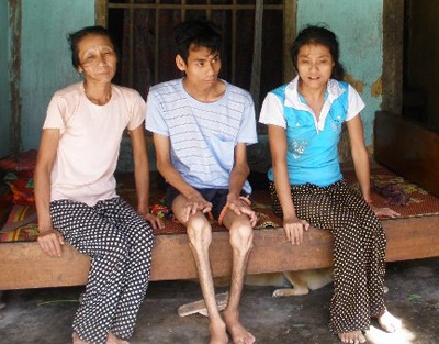  Xót thương cảnh mẹ già nuôi hai con nhiễm chất độc da cam - 1