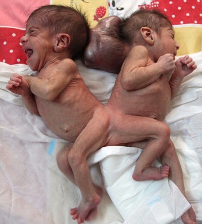 Quốc vương Ảrập Xê-út làm “người hùng” - 1