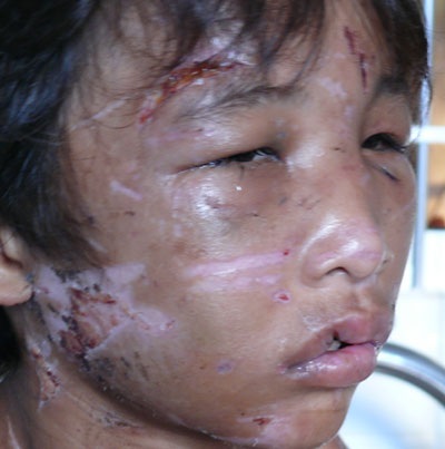 Nhìn lại quãng đời đau thương của “cậu bé thời trung cổ” - 1 Nhìn lại quãng đời đau thương của “cậu bé thời trung cổ” - 1