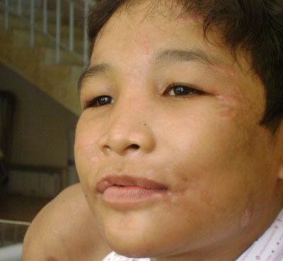 Nhìn lại quãng đời đau thương của “cậu bé thời trung cổ” - 2 Nhìn lại quãng đời đau thương của “cậu bé thời trung cổ” - 2