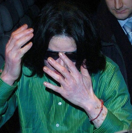 Con trai của Michael Jackson cũng gặp vấn đề về da - 3 Con trai của Michael Jackson cũng gặp vấn đề về da - 3