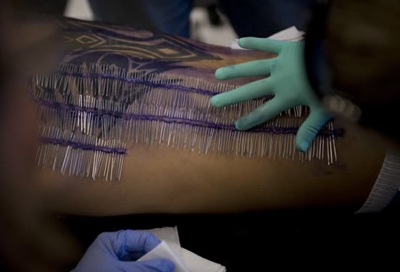 Kỷ lục xuyên hơn 1.000 chiếc kim khâu qua lưng - 3