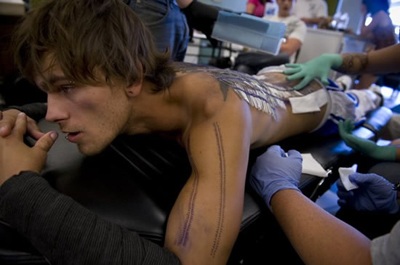 Kỷ lục xuyên hơn 1.000 chiếc kim khâu qua lưng - 5